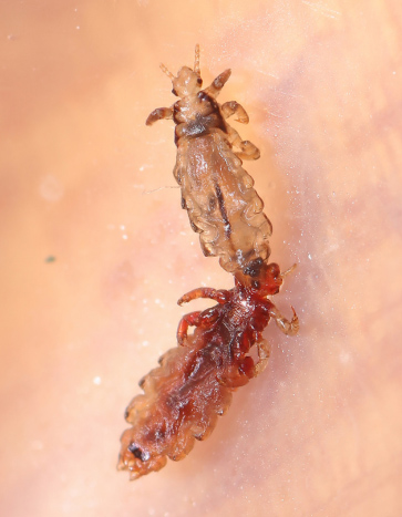 Head lice on palm - Back to School Pest Prevention