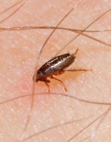 a flea feeding on a human - Flea Pest Control